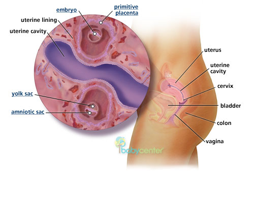 Fraternal twins in womb-4 weeks.jpg